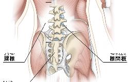 「ぎっくり腰」ってなんだろう？