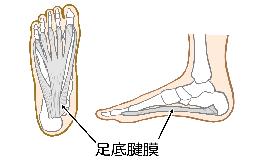 足の裏の痛みについて