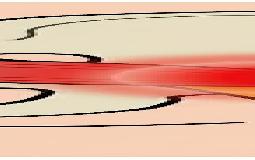 お尻から足の痺れ、痛み、ひょっとしてお尻の筋肉が原因かもしれません！